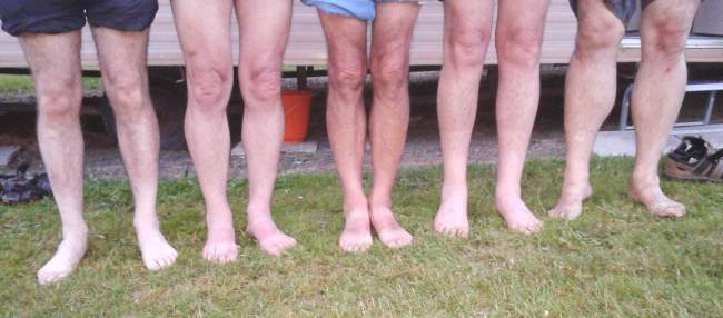 Legs at Bisley
